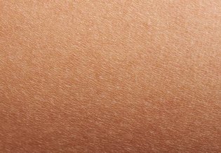 Artigo sobre dermatite atópica e pele seca - imagem principal