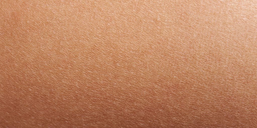 Larocheposay-ArticlePage-Eczema-Dry-skin-vs-eczema