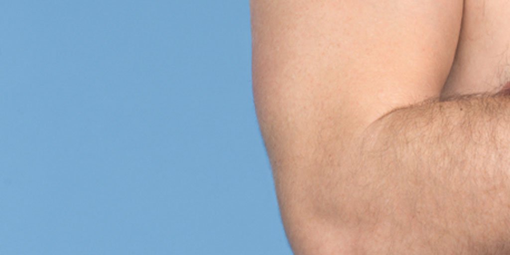 Pele Seca Tratamento E Prevencao La Roche Posay Pele Seca Tratamento E Prevencao La Roche Posay