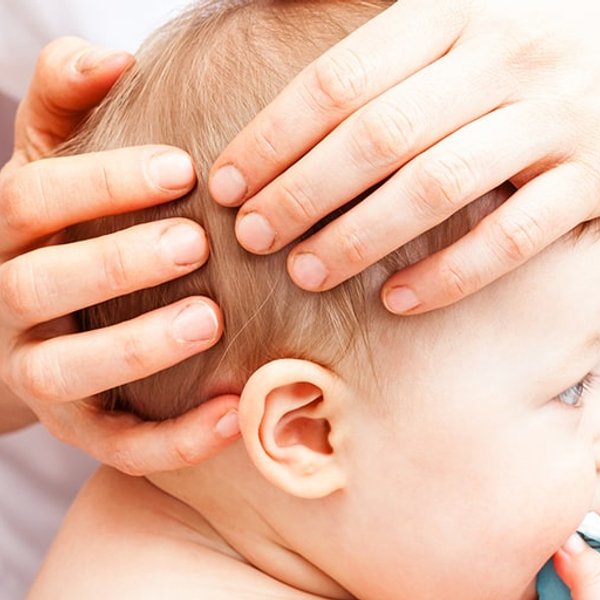 Dermatite seborreica também afeta os bebês
