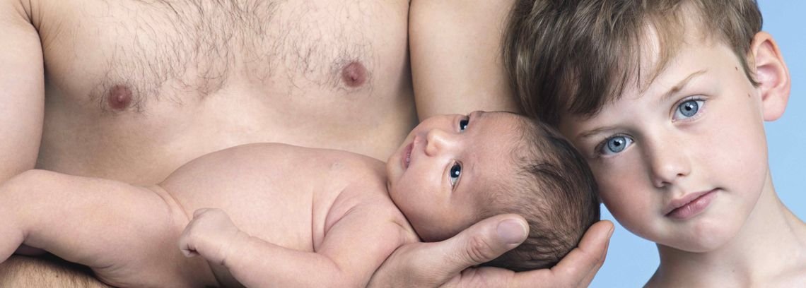 Eczema ou dermatite atópica