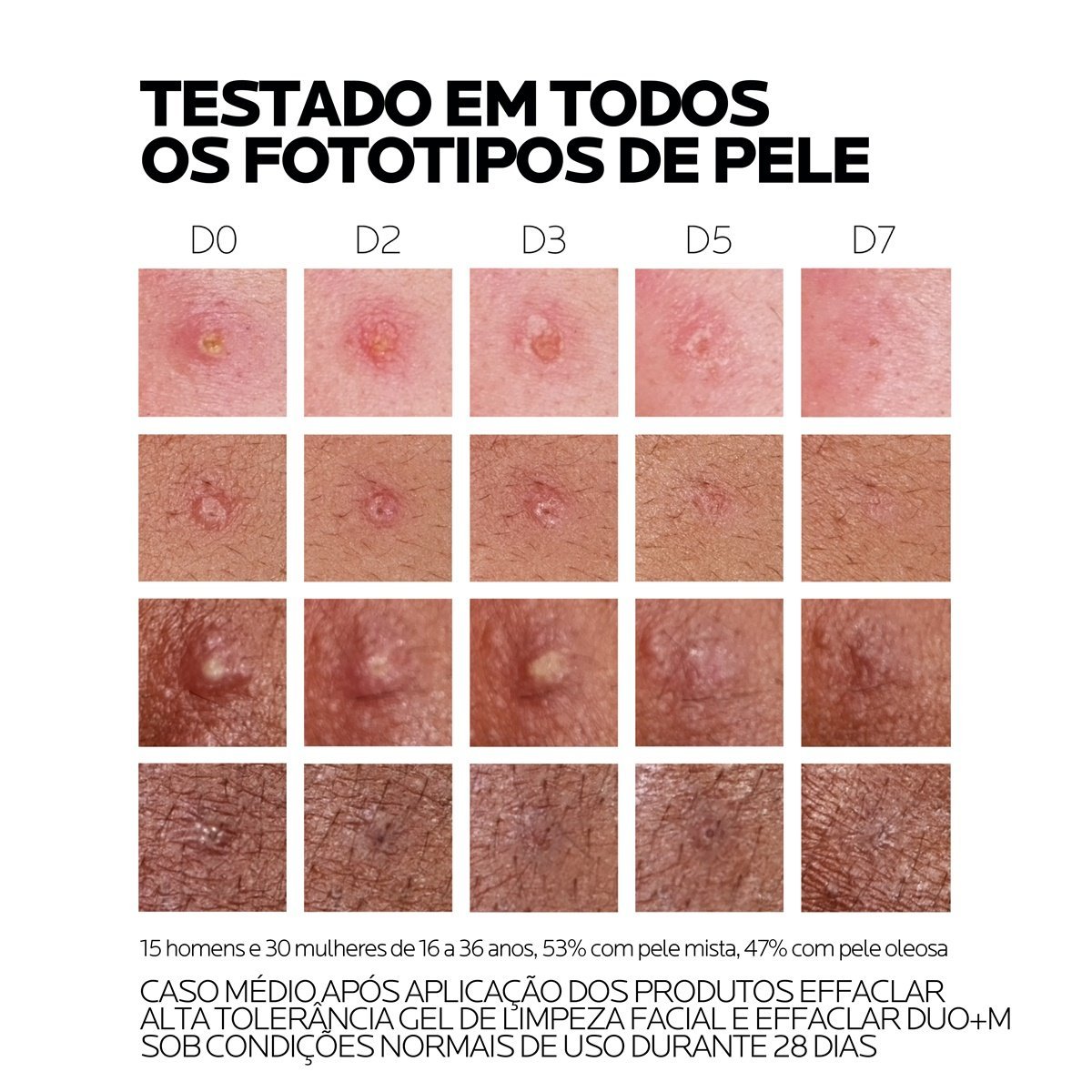 Effaclar Duo+M 40ml | Testes | La Roche Posay
