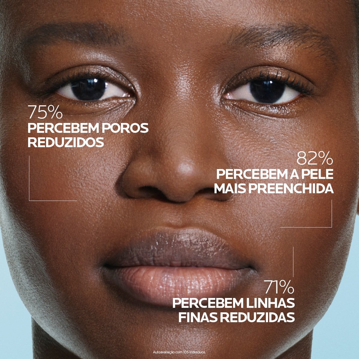 Benefícios.