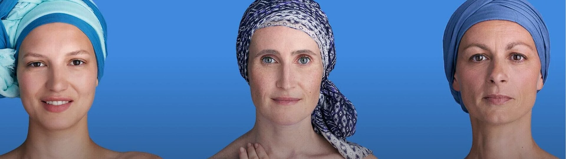 Acne Article - main image
